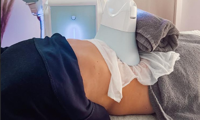 Découvrez la cryolipolyse au Cryo Centre Vaucluse à Carpentras