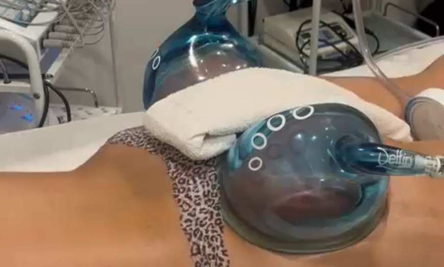 Image 2: Get Lifted with One, Two, or Three 40-Minute Non-Surgical Butt Lifts 