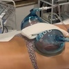 Image 2: Get Lifted with One, Two, or Three 40-Minute Non-Surgical Butt Lifts 