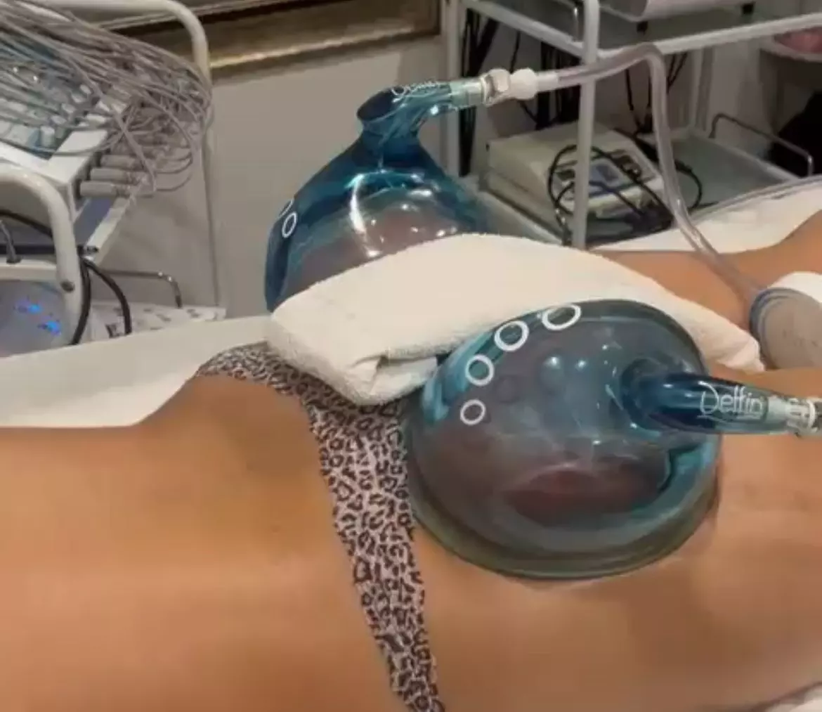 Get Lifted with One, Two, or Three 40-Minute Non-Surgical Butt Lifts 