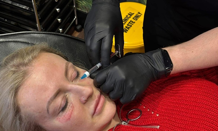 Image 4: Microneedling with Derma 2.0: 1 or 3 Skin-Revitalising Sessions