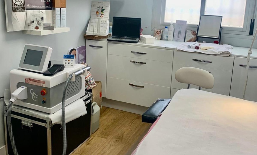 Image 5: 1 o 2 sesiones de peeling químico facial