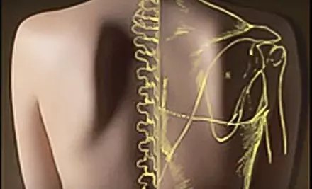 $40 for Pre-Massage MyoVision Muscle Scan, a 60-Minute Swedish Massage, and a 30-Minute Roller Table Massage at TLC Chiropractic Wellness Center ($140 Value) - Primary Image