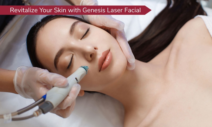 Image 1: Enhance w/ One or Two Sessions of Genesis Laser Facial on Full Face