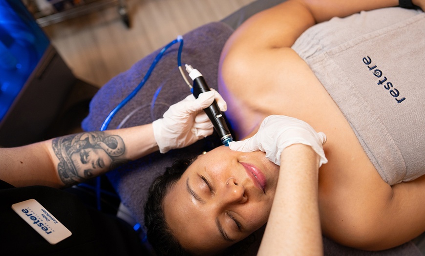 Image 2: Hydrate and Glow with Signature HydraFacials in Las Vegas