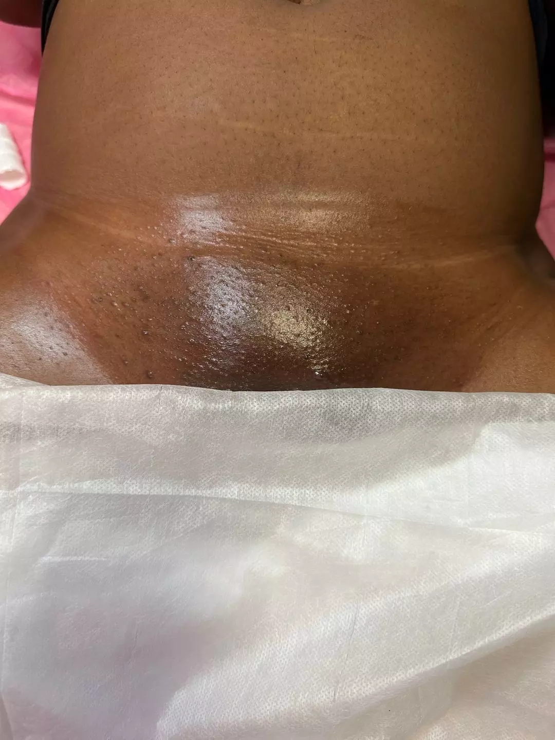 Experience Smoothness with 1, 3, or 5 Brazilian/Bikini Wax Options