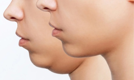 Fat Melting Meso Therapy (Small Area)  - Skulpt Haus