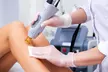 Up to 53% Off Eight Laser Hair Removal Sessions for XS to XL Area at Lotus Health & Aesthetics Spa - Second Medium