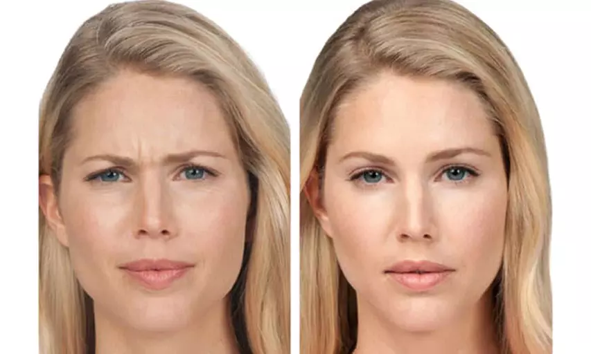 Expert Injectables to Smooth Wrinkles & Enhance Beauty