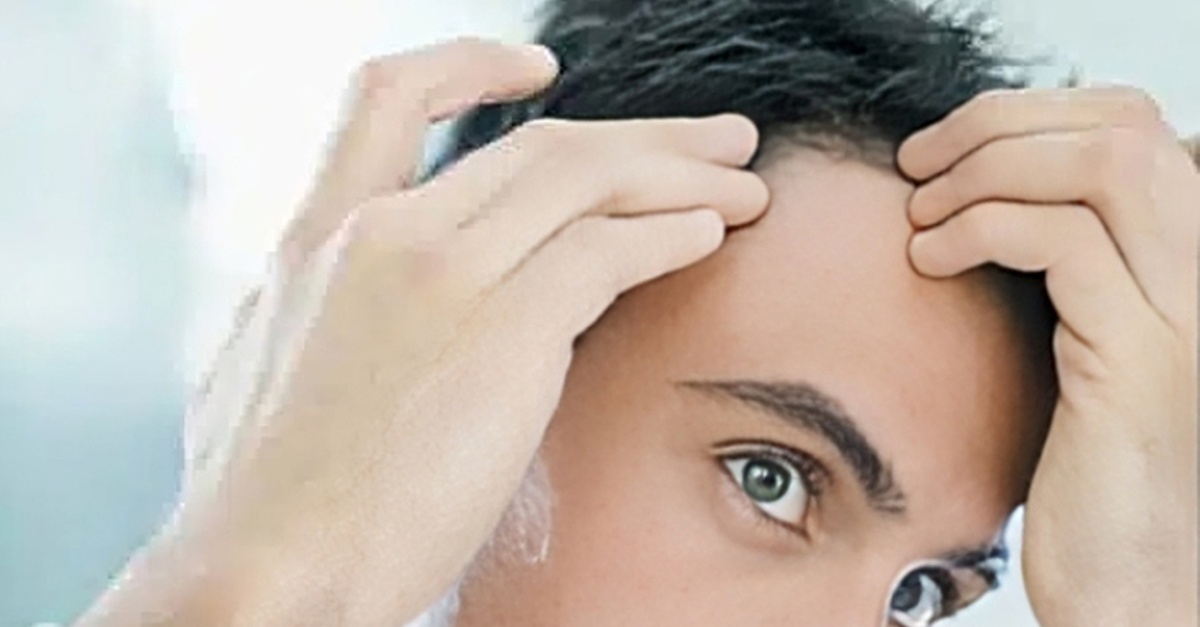 Tratamiento capilar de bioestimulación o mesoterapia en Madrid