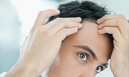 Bioestimulación capilar: 1 Sesión - CLINICA ESTETICA BIOESTETIC