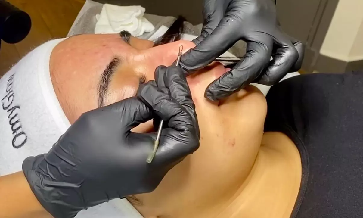 Soin du visage détox glow (50 min) ou rituel kobido (1h) avec LED avec O'myGlow (jusqu'à 54% de remise) - Second Medium