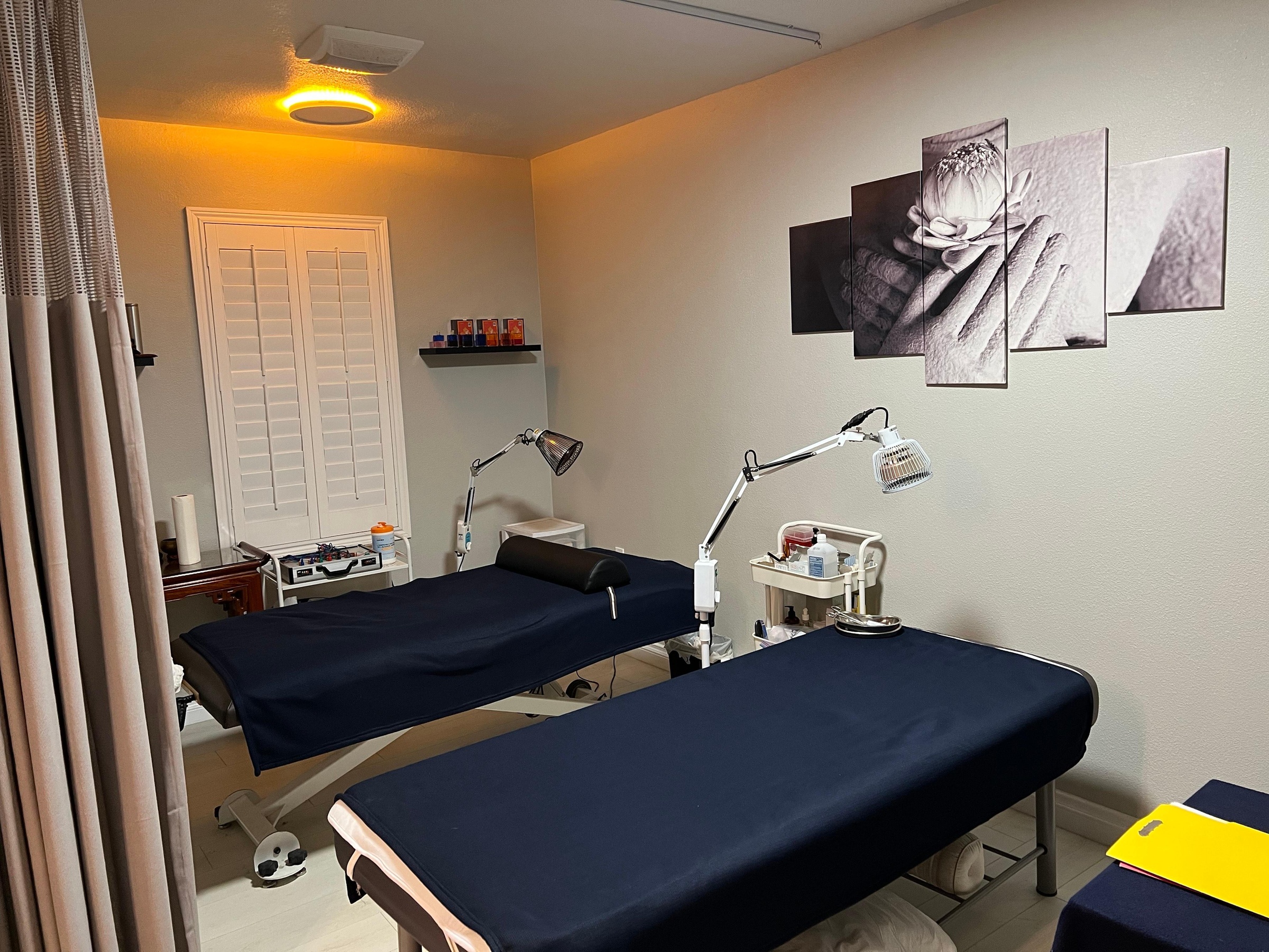 Up to 43% Off on Cupping at LITS Acupuncture And yoga