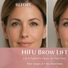 Image 1: HIFU Brow Lift & Fine Line Smoothing (No Needles)