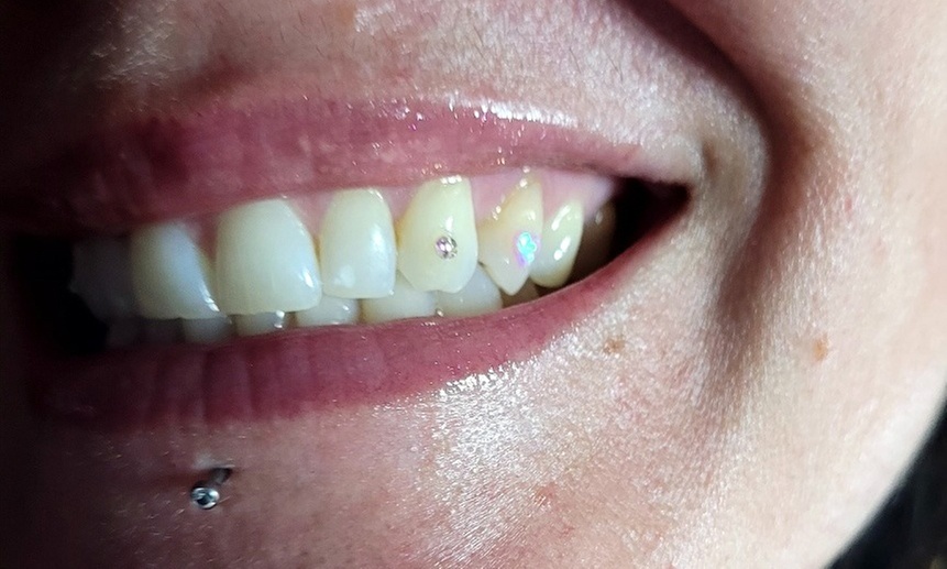 Shine Bright: Real Swarovski CRYSTAL Tooth Gems Or 1 OPAL Tooth Gem
