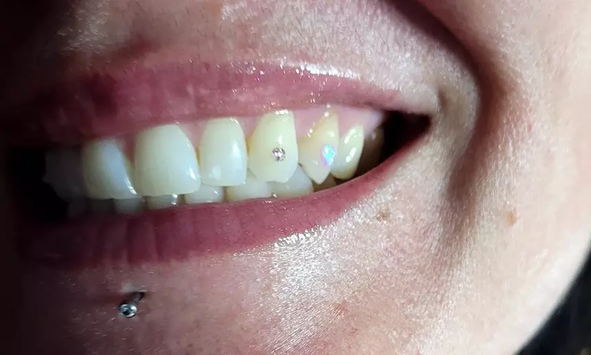 Shine Bright: Real Swarovski CRYSTAL Tooth Gems Or 1 OPAL Tooth Gem
