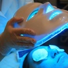 Image 5: Higiene facial completa con opción a tratamientos adicionales para 1