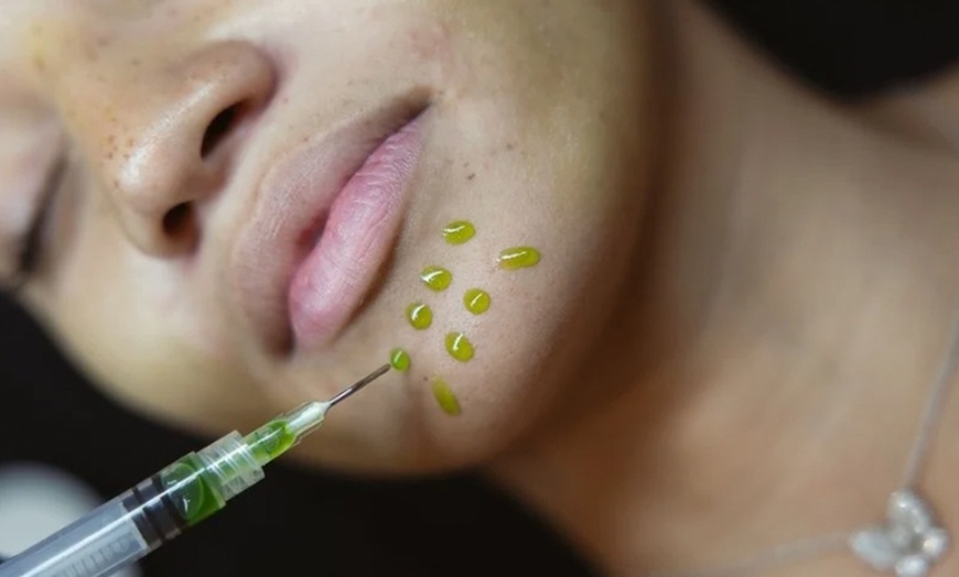 Image 8: Up to 63% Off on Chemical Peel at Allure Passions Aesthetic Clinic