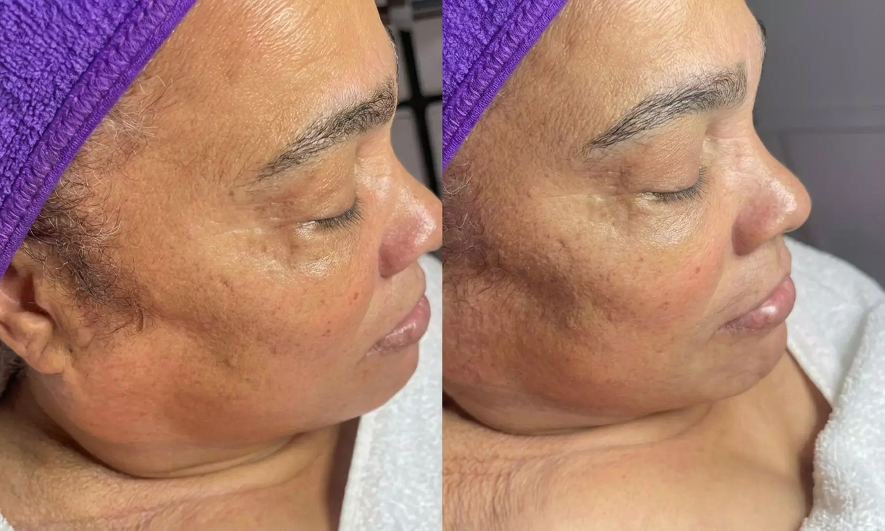 Head to Toe Glow: Rejuvenating Facials & Relaxing Massages