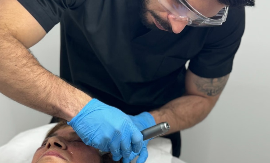 Image 3: Hidratación de labios efecto volumen con hyaluron pen