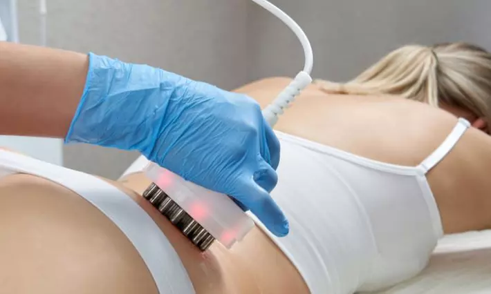 1 o 2 sesiones de radiofrecuencia corporal para 1 persona