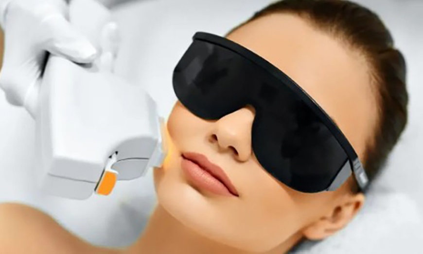 Image 2: Three or Six Laser Removal Sessions on 1 Small, Medium or Large Areas 