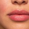 Image 1:  Juvederm + Botox —  40% Off at Beauty Factory SD
