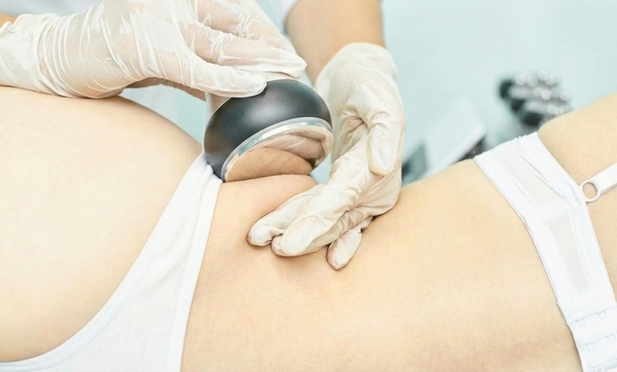 Image 4: CryoLipo-EMS: Skin-Tightening, Cellulite Reduction, Fat Eliminator
