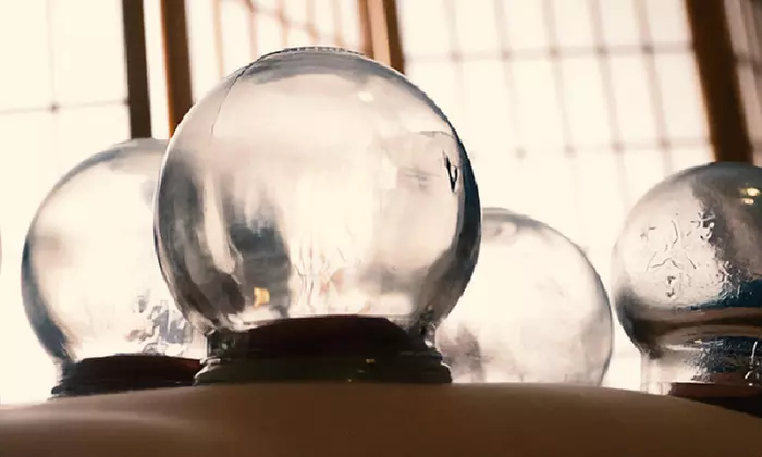 Feel Rejuvenated with One or Three Hijama Sunnah Cupping Sessions