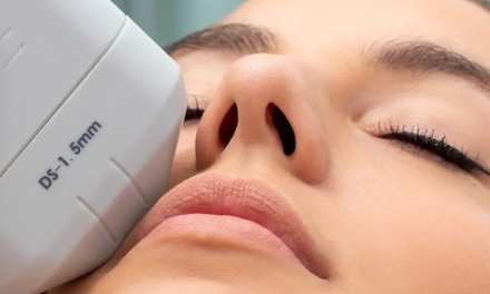 HIFU (Radar Carving) - Eye area - North London Aesthetic Clinic
