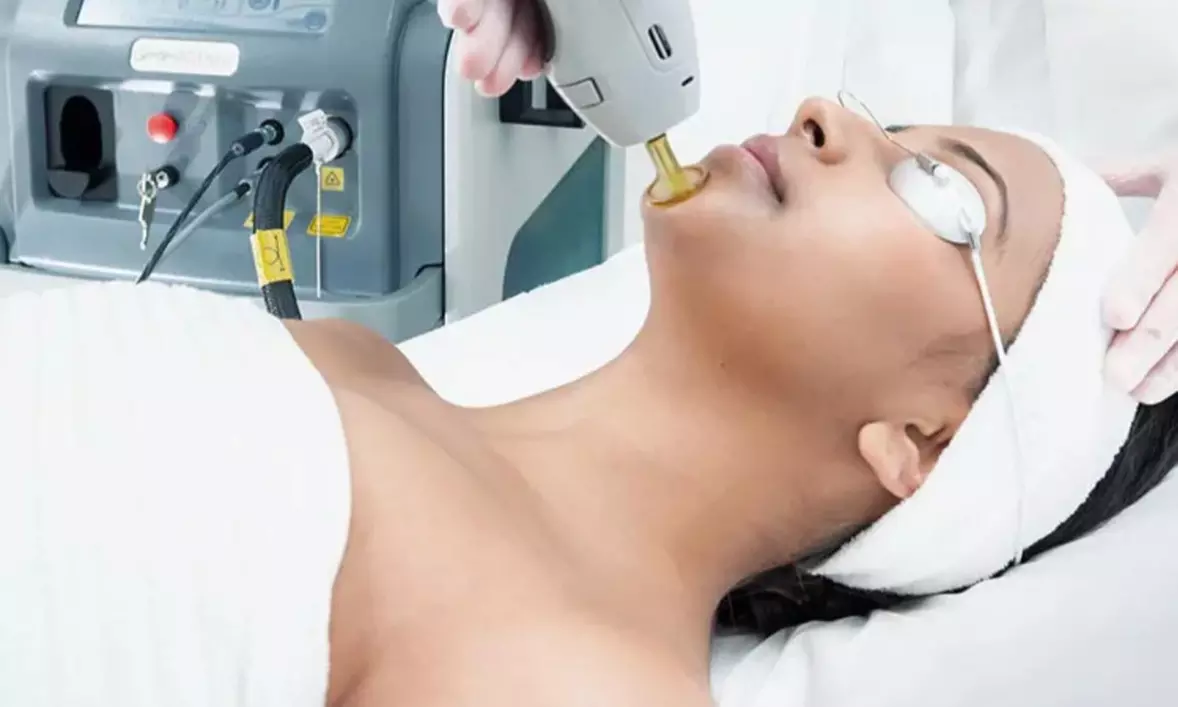 Six Laser Hair Removal Sessions on One Small, Medium, or Large Area at TAO SPA GROUP (Up to 52% Off) - Primary Image