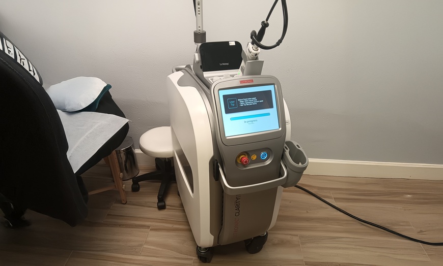 Image 3: Rejuvenate with One, Two, or Three Micro-Needling Sessions For One 