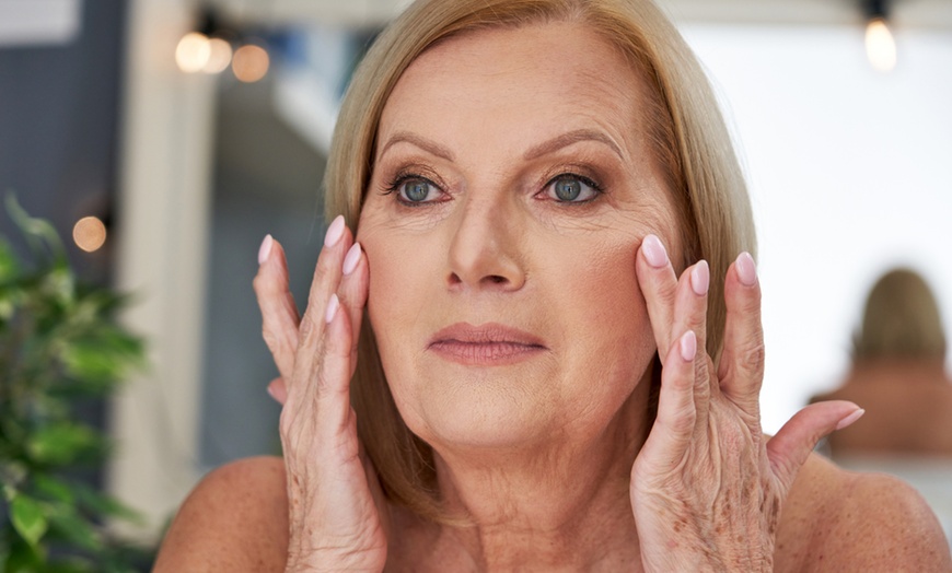 Image 2: Up to 50% Off on Fine Line Reduction at Belleza Cosmetic Clinic - CBD