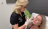 Enhance Your Beauty with 20 Units of Jeuveau on One Area at 4Ever Young Fort Myers (Up to 37% Off)