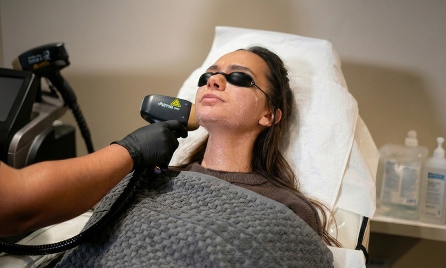 Image 8: Soprano ICE Titanium Laser Hair Removal on Small, Medium or Large Area