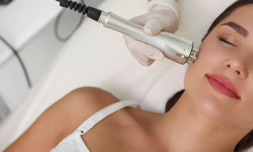 Image 1: Limpieza facial profunda y opción a radiofrecuencia, vitamina C y más