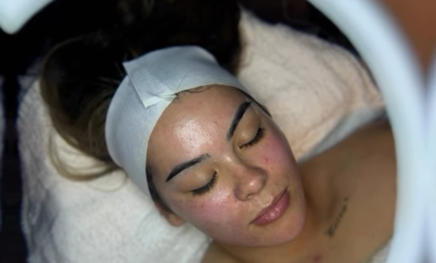 Image 5: Rejuvenate with One, Three, or Five Sessions of 60 Min Custom Facial! 