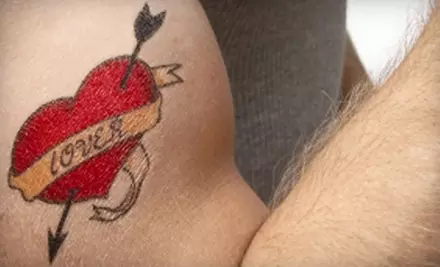 $49 for Laser Tattoo Removal for up to 9 Square Inches at Precision Laser Tattoo Removal (Up to $228 value) - Primary Image