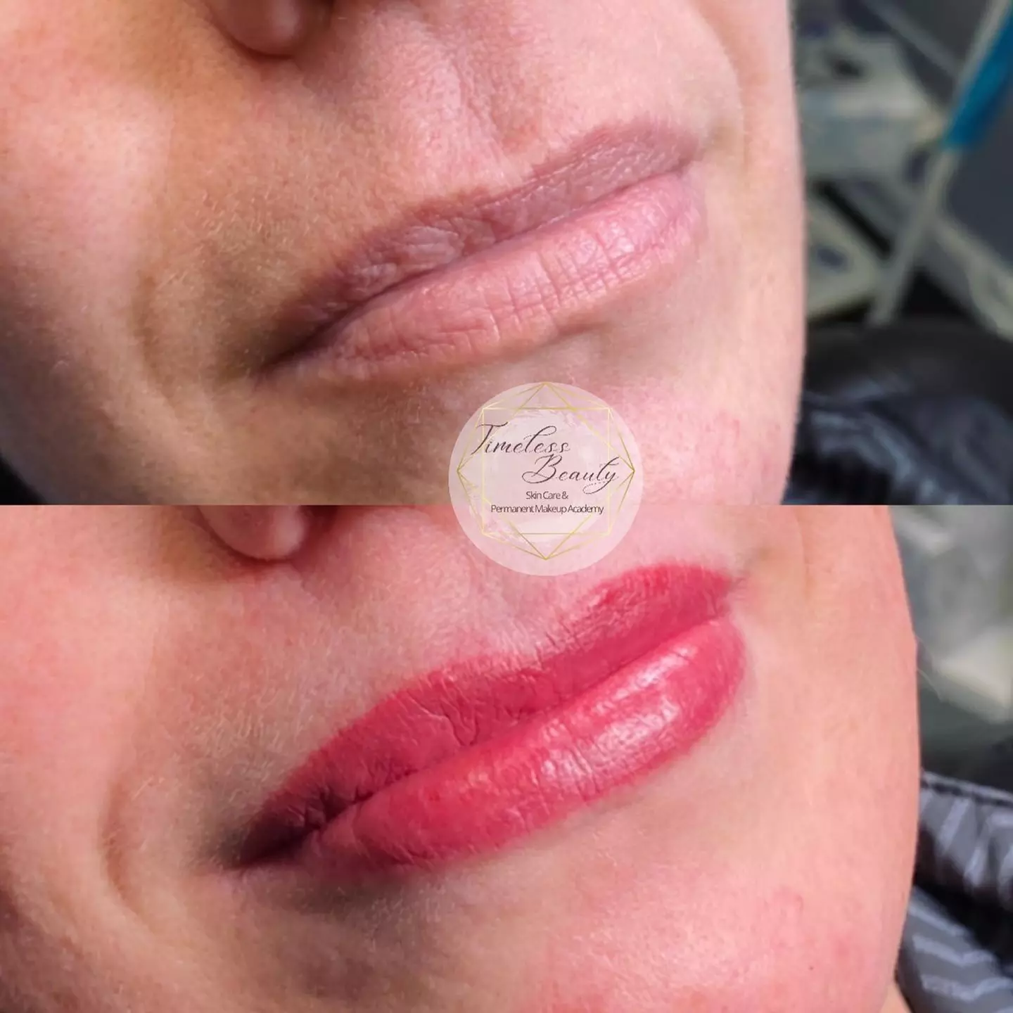 Achieve Flawless Looks with Permanent Lip Enhancements