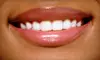 $49 for Invisalign or Orthodontic Exam Plus $1,000 Off Total Adult or Teen Invisalign or Braces Treatment Cost. Five Locations Available.