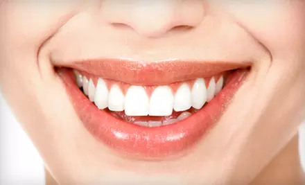 $79 for an In-Office Teeth Whitening at Laser Light & Sound ($222.88 Value) - Primary Image