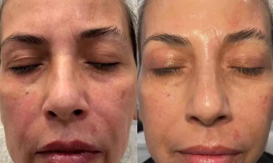 One, Two or Three Sessions of 75-Minute Glow and Go Facial  