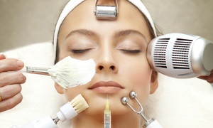 Up to 71% Off on IPL PhotoFacial with Microdermabrasion