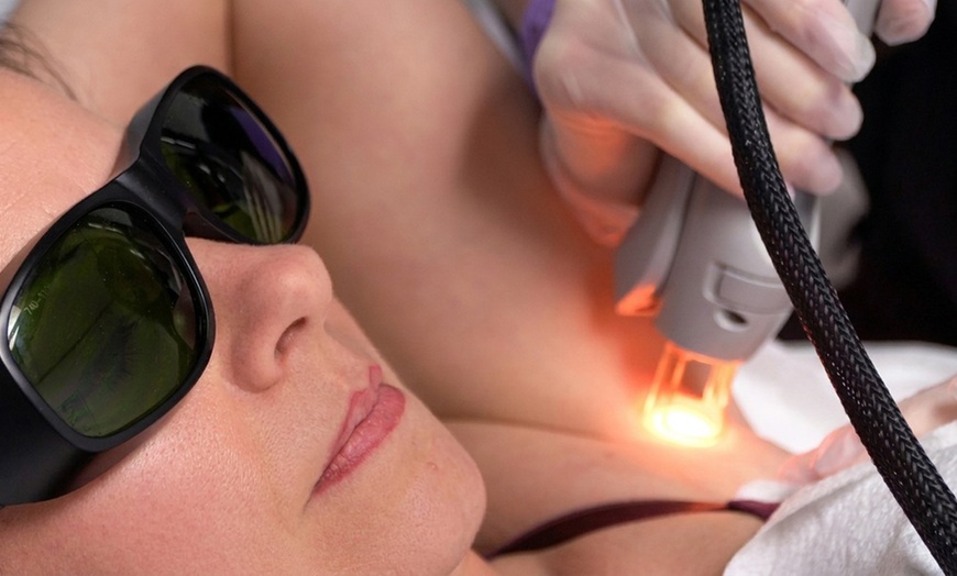 Image 2: Long-lasting Smooth Skin with Laser Hair-Removal Sessions