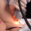 Image 2: Long-lasting Smooth Skin with Laser Hair-Removal Sessions