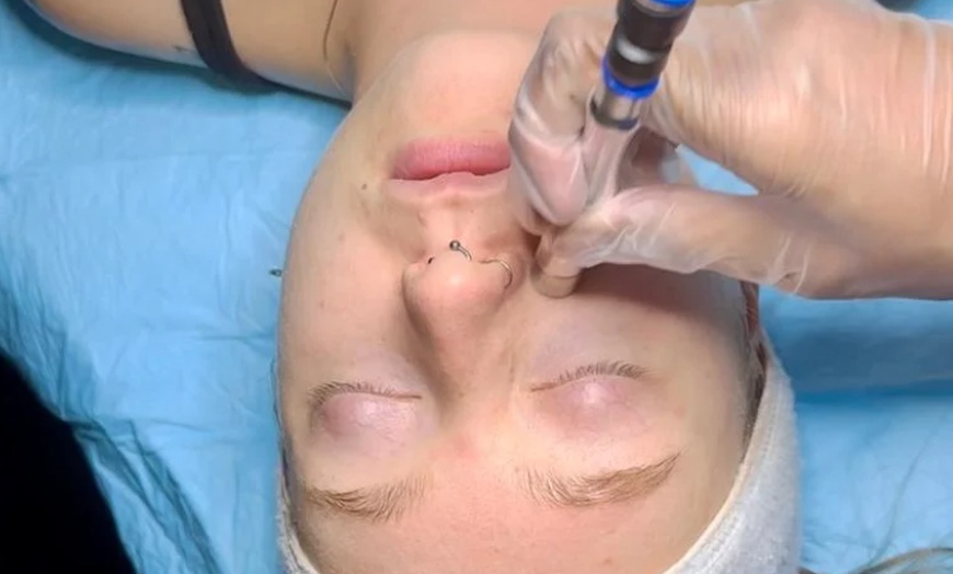 Image 1: Glow + Sculpt: The Ultimate Hydraglow Microdermabrasion