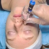 Image 1: Up to 40% Off  Hydraglow Microdermabrasion at Rise Skin Spa