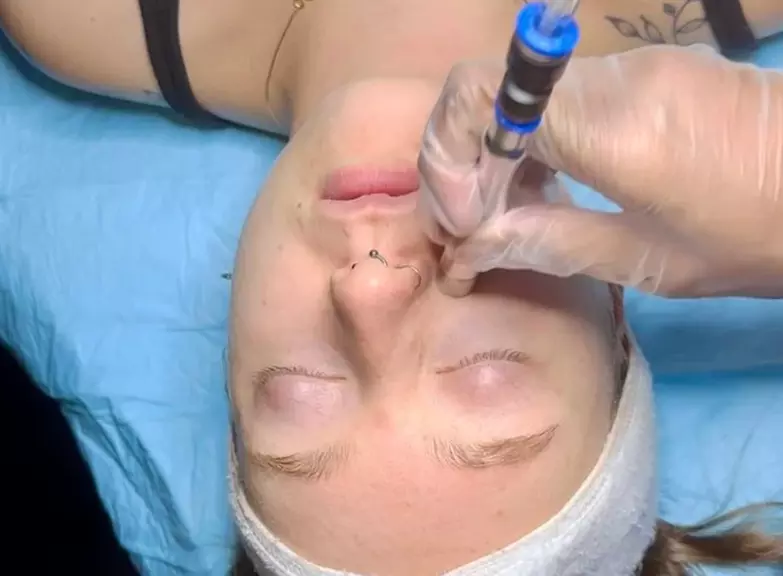 Glow + Sculpt: The Ultimate Hydraglow Microdermabrasion at Rise Skin Spa (Up to 45% Off ) - Primary Image