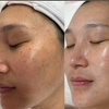 Image 1: Choose from Tailored Facials and More to Revitalize Your Skin Today