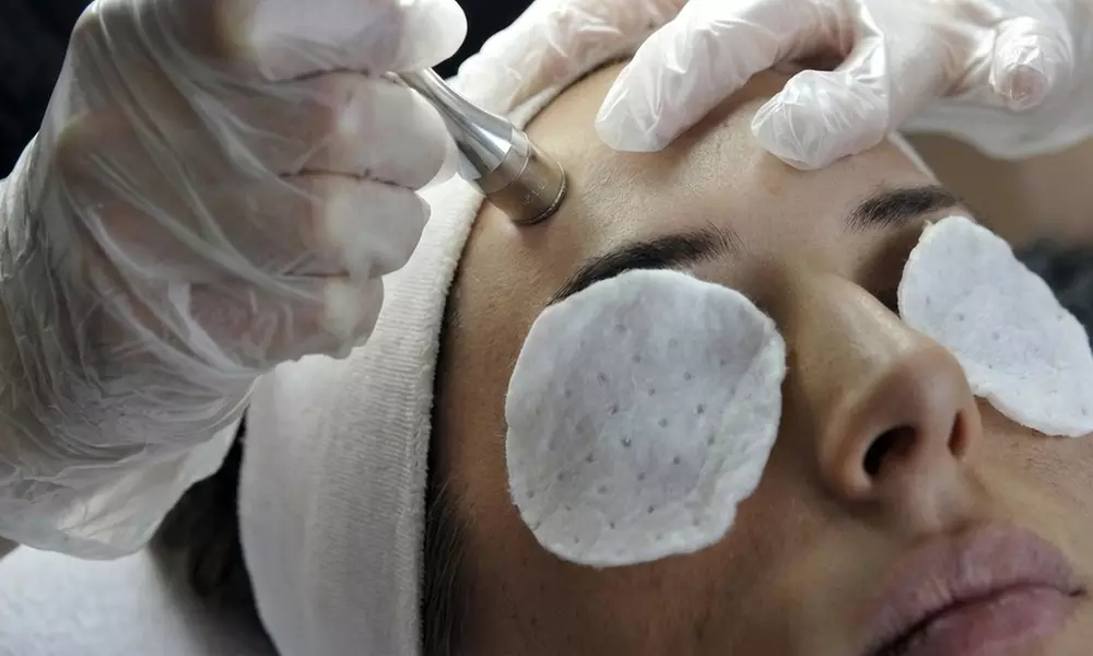 Microdermabrasion Facial with Buccal Massage Sculpting Glow